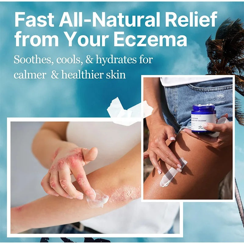 Eczema Ocean - Advanced Skin Treatment!